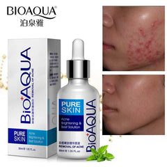 BioAqua Pure Skin Anti Acne Serum Facial Removal Solution - YehChez.pk