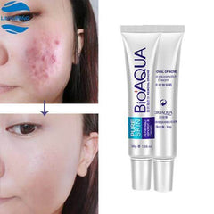 BioAqua Acne Cream Anti-Wrinkle Removal Scar Blemish Marks Removal Unisex - YehChez.pk