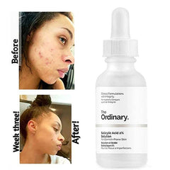 The Ordinary Salicylic Acid 2% Solution 30ml - YehChez.pk