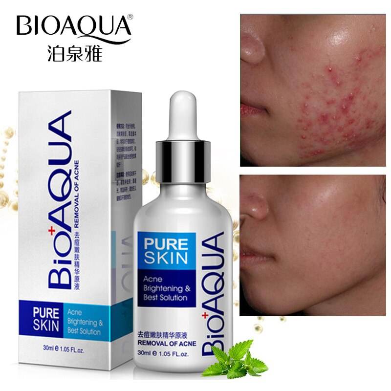 BioAqua Pure Skin Anti Acne Serum Facial Removal Solution - YehChez.pk