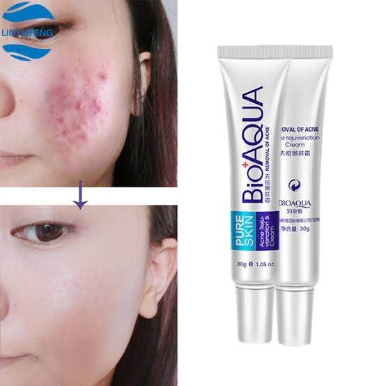 BioAqua Acne Cream Anti-Wrinkle Removal Scar Blemish Marks Removal Unisex - YehChez.pk