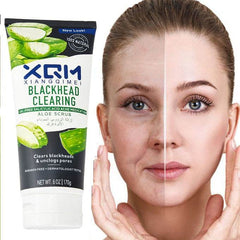 XQM Blackhead clearing Aloe Scrub 170Gm - YehChez.pk